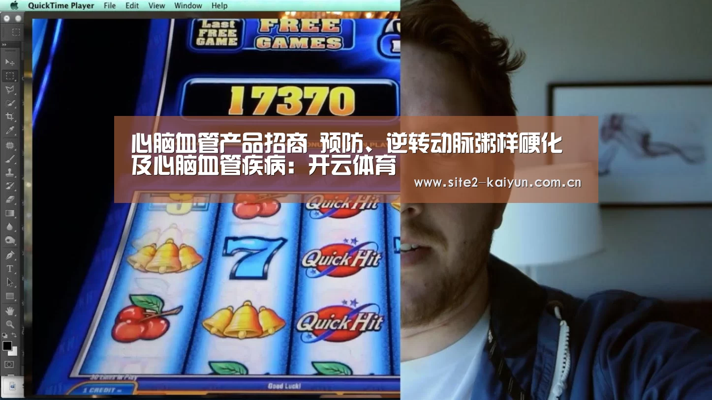心脑血管产品招商 预防、逆转动脉粥样硬化及心脑血管疾病:开云体育(图3) 开云体育